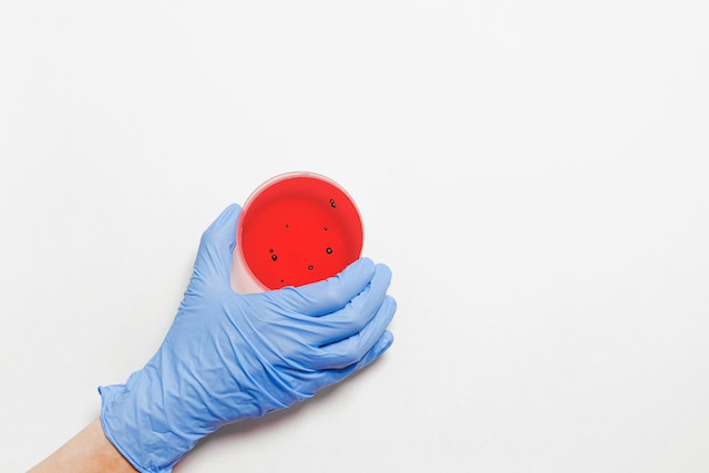 PCR test